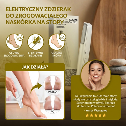 Elektryczny Zdzierak Do Zrogowaciałego Naskórka Na Stopy